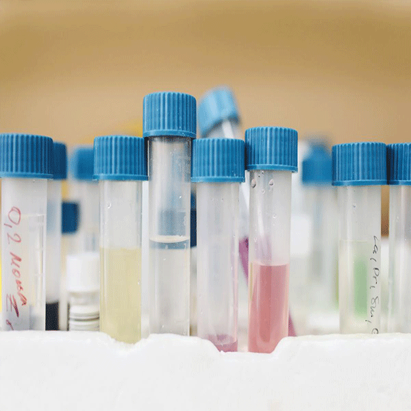 How Much Do You Know about Test Tube? Suzhou Elite Plastics Co., Ltd